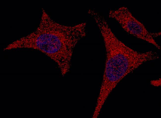 alanyl-tRNA Synthetase Antibody in Immunocytochemistry (ICC/IF)