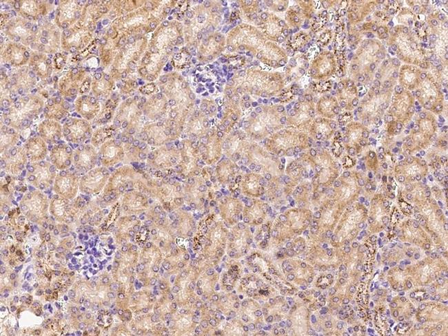 ADAMTS4 Antibody in Immunohistochemistry (Paraffin) (IHC (P))