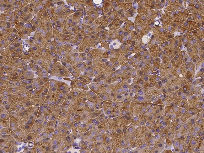 CEL Antibody in Immunohistochemistry (Paraffin) (IHC (P))