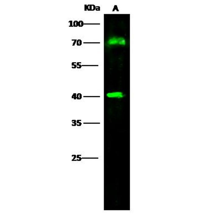 CD64 Antibody in Western Blot (WB)