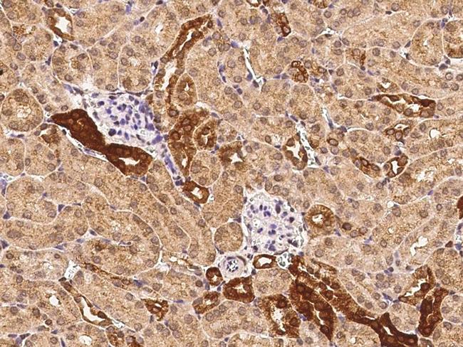 FDPS Antibody in Immunohistochemistry (Paraffin) (IHC (P))