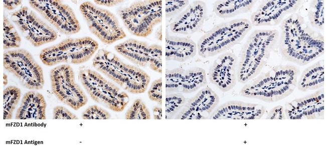 FZD1 Antibody in Immunohistochemistry (Paraffin) (IHC (P))