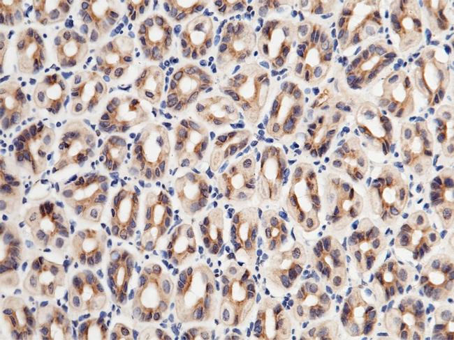 Growth Hormone Receptor Antibody in Immunohistochemistry (Paraffin) (IHC (P))