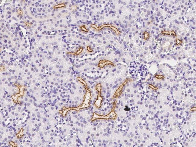 IGFBP2 Antibody in Immunohistochemistry (Paraffin) (IHC (P))