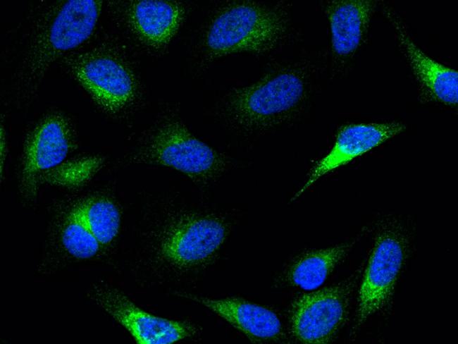 PCSK9 Antibody in Immunocytochemistry (ICC/IF)