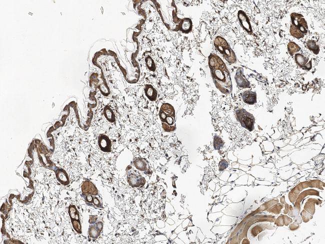 TROP2 Antibody in Immunohistochemistry (Paraffin) (IHC (P))