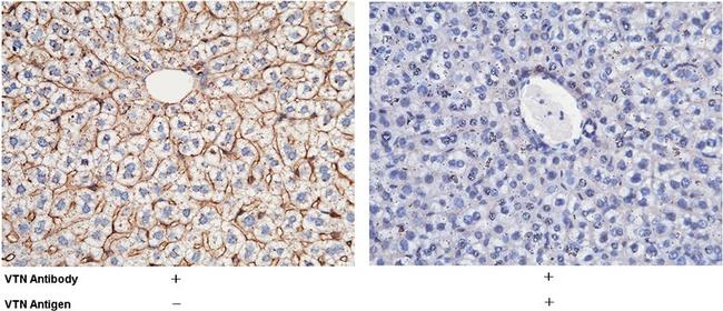 Vitronectin Antibody in Immunohistochemistry (Paraffin) (IHC (P))