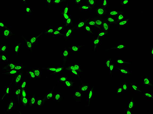 DDX5 Antibody in Immunocytochemistry (ICC/IF)