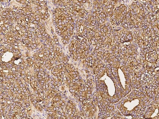 FGF10 Antibody in Immunohistochemistry (Paraffin) (IHC (P))