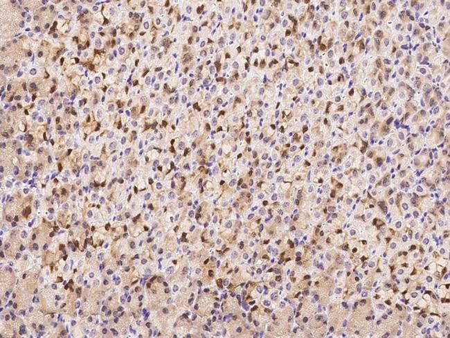 Calcineurin A Antibody in Immunohistochemistry (Paraffin) (IHC (P))