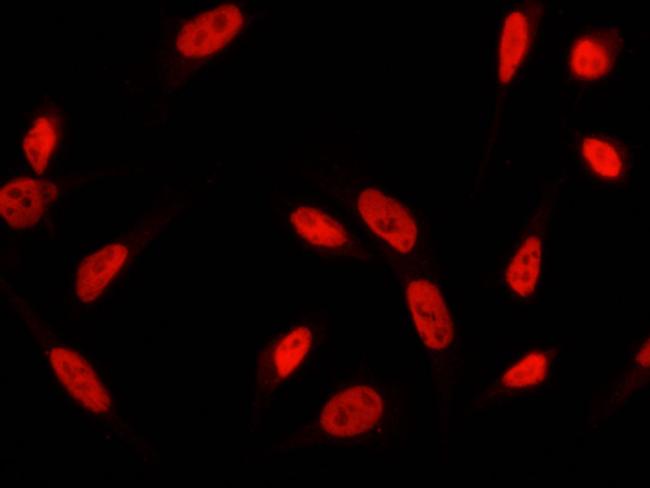 RbAp48 Antibody in Immunocytochemistry (ICC/IF)