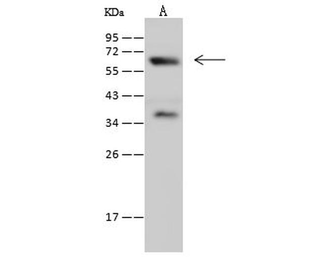 Synaptotagmin 1 Antibody in Western Blot (WB)