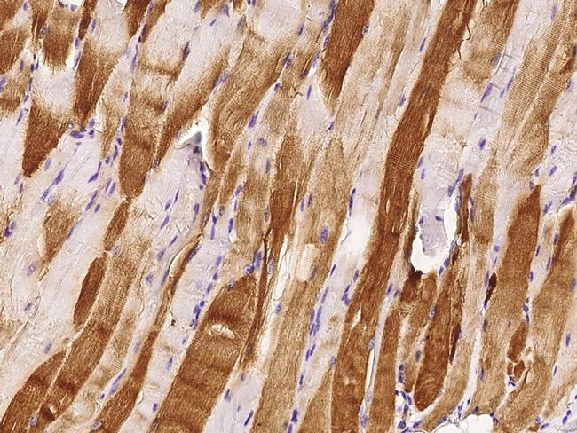 Cardiac Troponin C Antibody in Immunohistochemistry (Paraffin) (IHC (P))