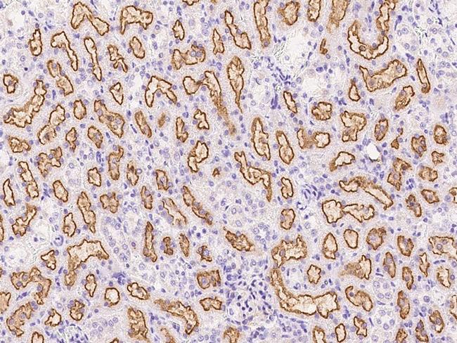 EphB2 Antibody in Immunohistochemistry (Paraffin) (IHC (P))