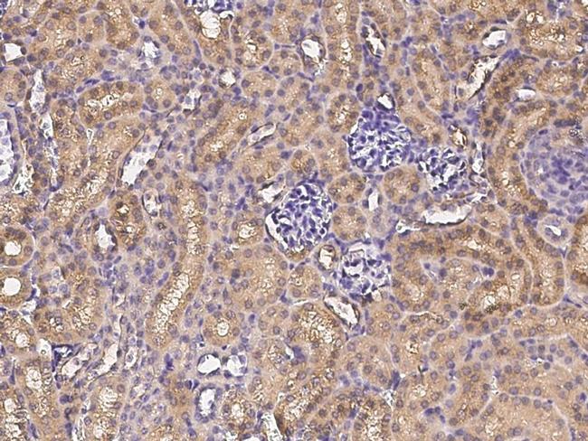 CD171 Antibody in Immunohistochemistry (Paraffin) (IHC (P))