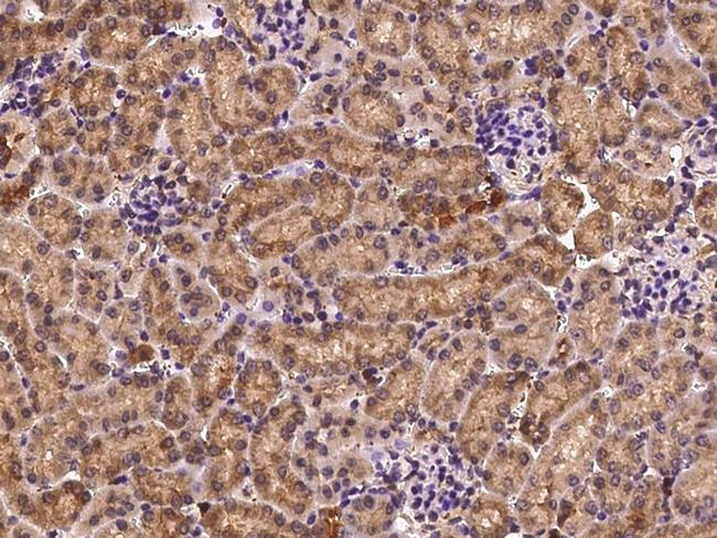 Profilin 1 Antibody in Immunohistochemistry (Paraffin) (IHC (P))