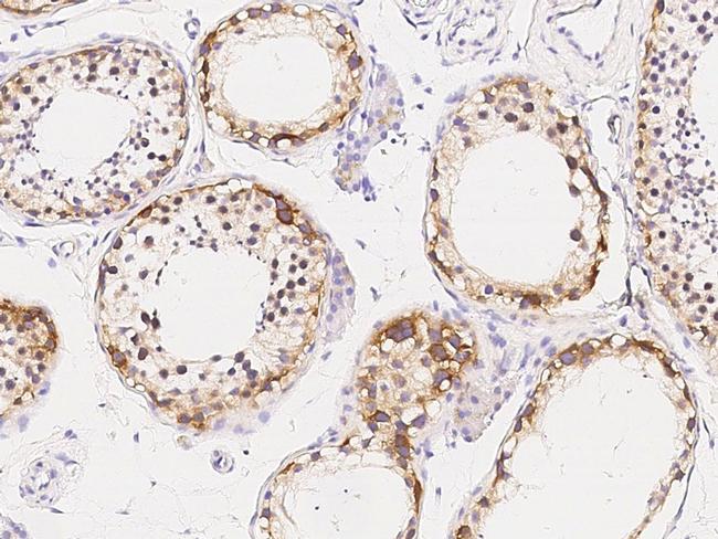 CD30 Antibody in Immunohistochemistry (Paraffin) (IHC (P))