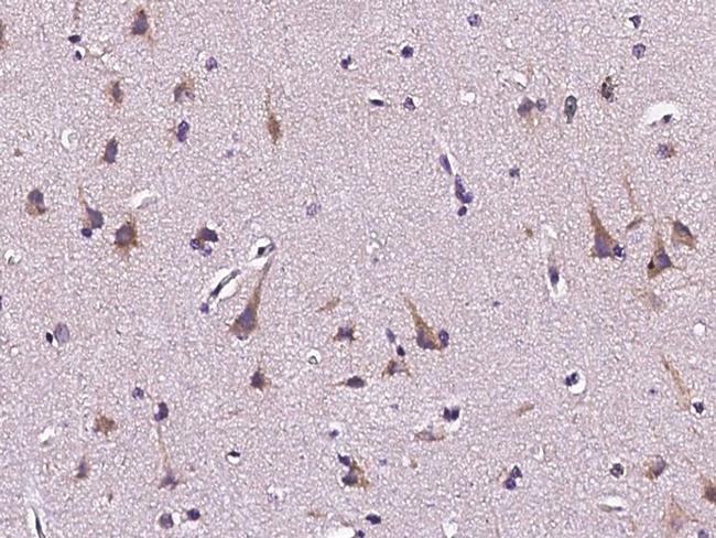 PDGFRB Antibody in Immunohistochemistry (Paraffin) (IHC (P))