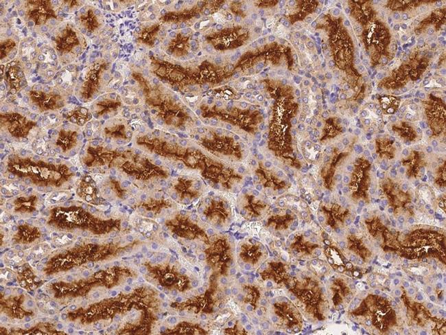 Folate Receptor alpha Antibody in Immunohistochemistry (Paraffin) (IHC (P))