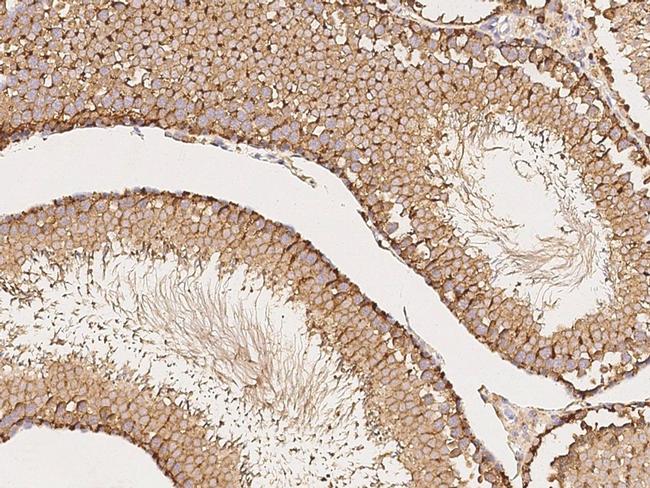 NPC2 Antibody in Immunohistochemistry (Paraffin) (IHC (P))