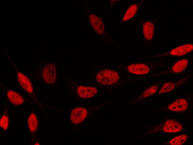 PCNA Antibody in Immunocytochemistry (ICC/IF)