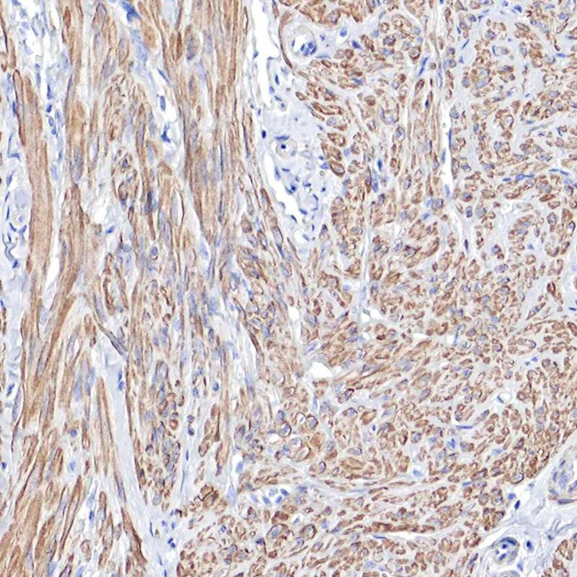 TPM1 Antibody in Immunohistochemistry (Paraffin) (IHC (P))