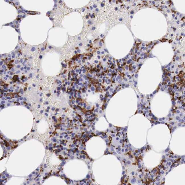 CD204 Antibody in Immunohistochemistry (Paraffin) (IHC (P))