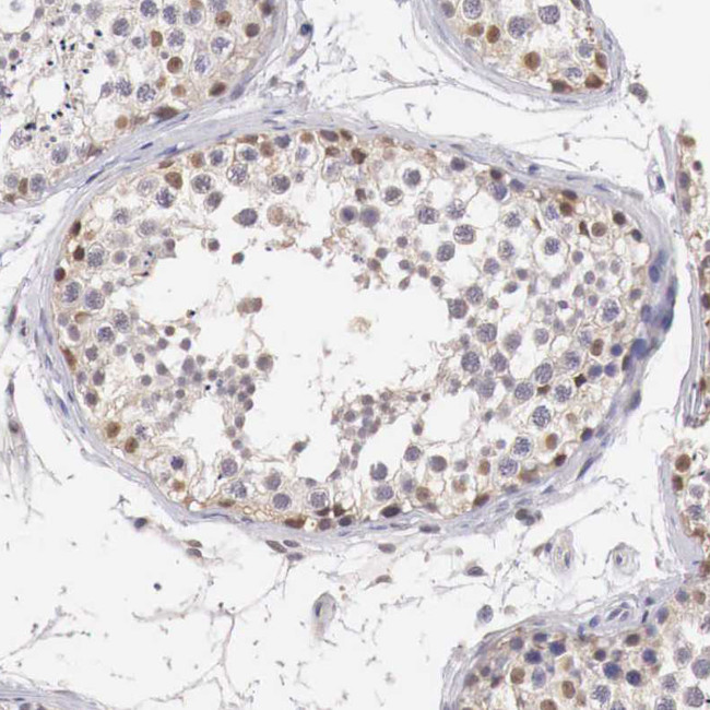 UBE1 Antibody in Immunohistochemistry (Paraffin) (IHC (P))