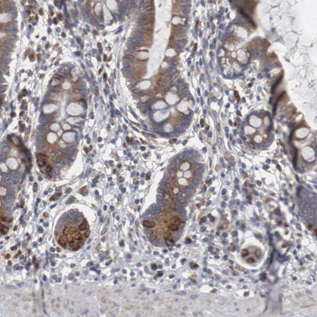 CTAGE5 Antibody in Immunohistochemistry (Paraffin) (IHC (P))