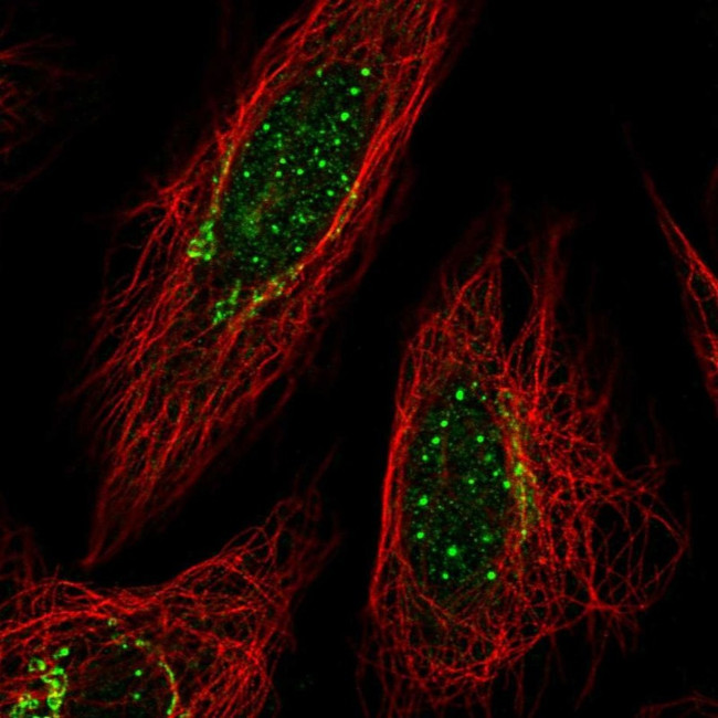 Thymidine Phosphorylase Antibody in Immunocytochemistry (ICC/IF)