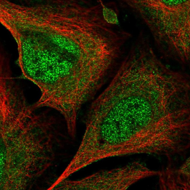 CrkL Antibody in Immunocytochemistry (ICC/IF)