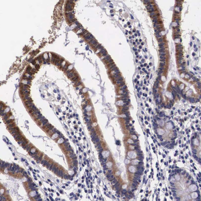 Arginase 2 Antibody in Immunohistochemistry (Paraffin) (IHC (P))