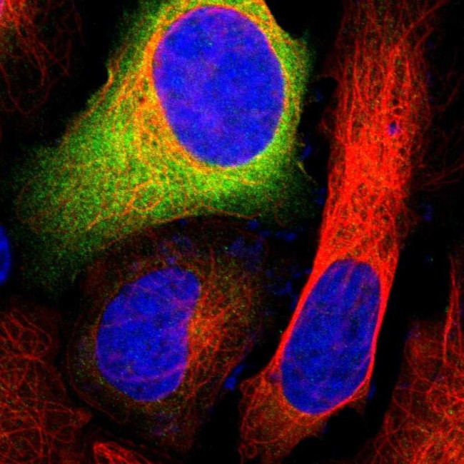 G6PD Antibody in Immunocytochemistry (ICC/IF)