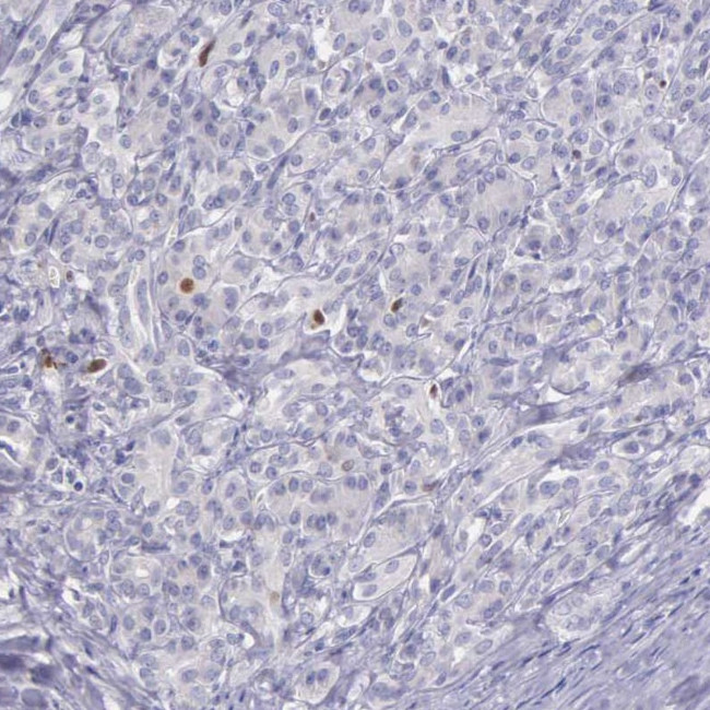 MCM5 Antibody in Immunohistochemistry (Paraffin) (IHC (P))