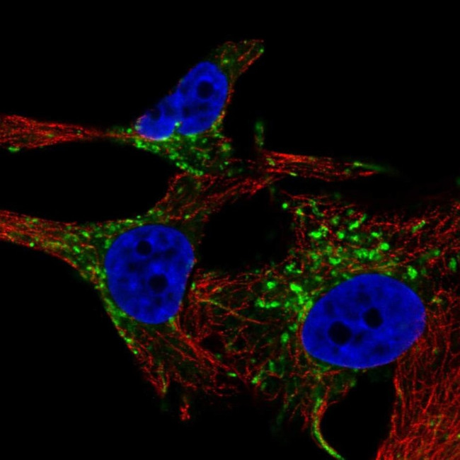 TYRP1 Antibody in Immunocytochemistry (ICC/IF)