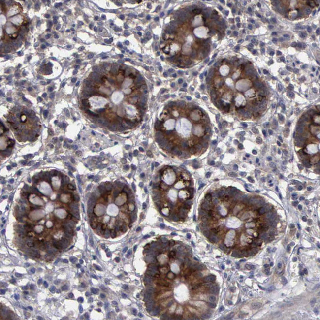 CrkL Antibody in Immunohistochemistry (Paraffin) (IHC (P))