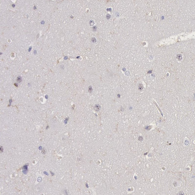 Lyn Antibody in Immunohistochemistry (Paraffin) (IHC (P))