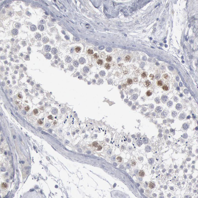 DMC1 Antibody in Immunohistochemistry (Paraffin) (IHC (P))