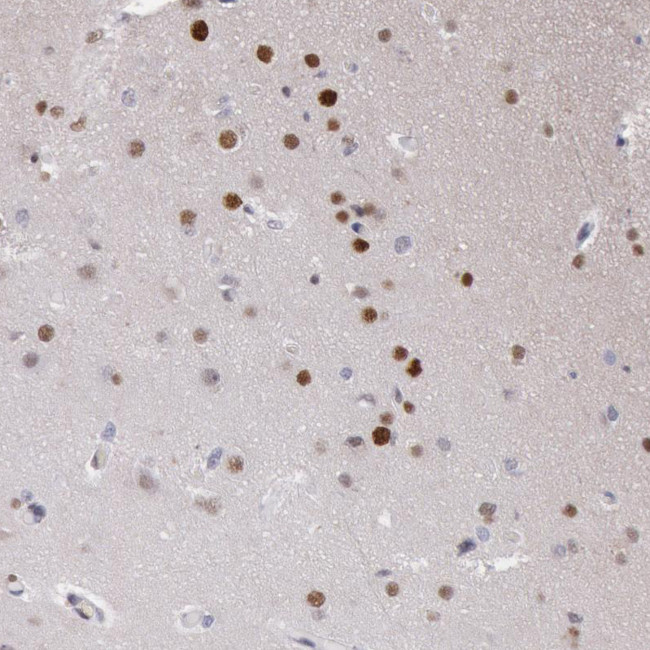 MSK1 Antibody in Immunohistochemistry (Paraffin) (IHC (P))