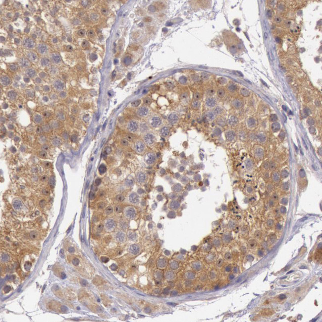 PCTAIRE1 Antibody in Immunohistochemistry (Paraffin) (IHC (P))