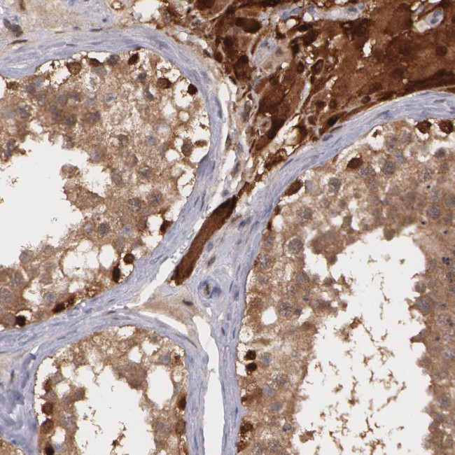 TrxR1 Antibody in Immunohistochemistry (Paraffin) (IHC (P))