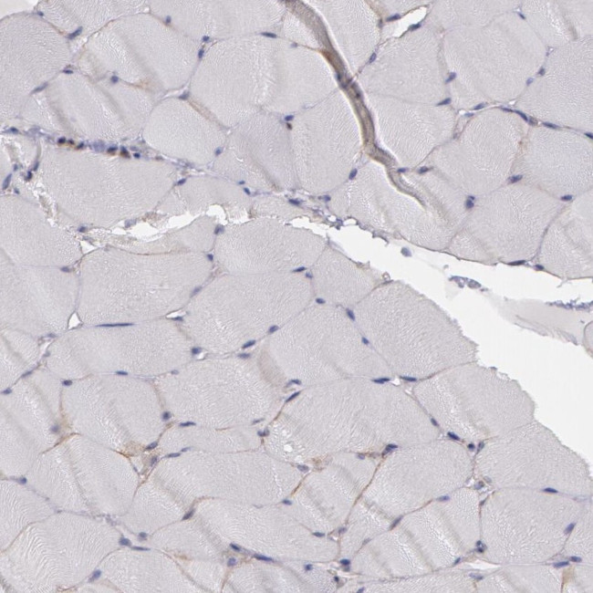 Flotillin 2 Antibody in Immunohistochemistry (Paraffin) (IHC (P))