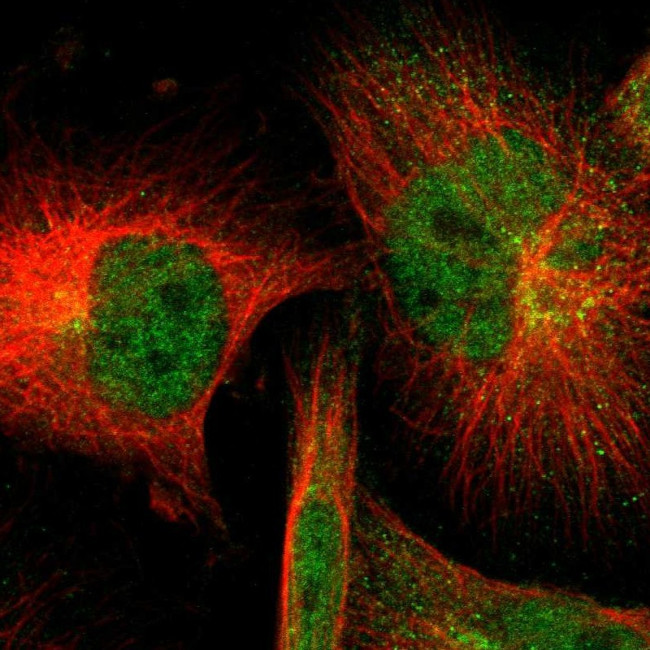 SOD1 Antibody in Immunocytochemistry (ICC/IF)