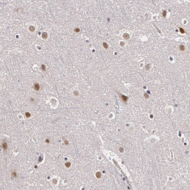 PLZF Antibody in Immunohistochemistry (Paraffin) (IHC (P))