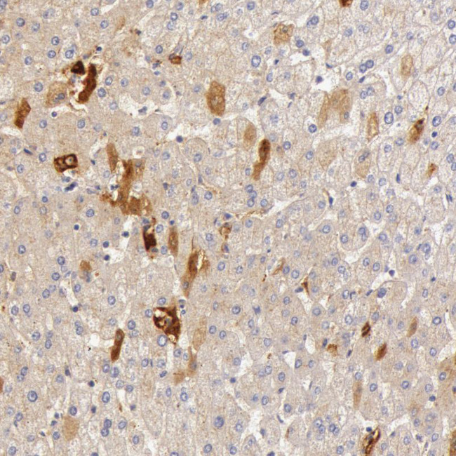 C4BPA Antibody in Immunohistochemistry (Paraffin) (IHC (P))