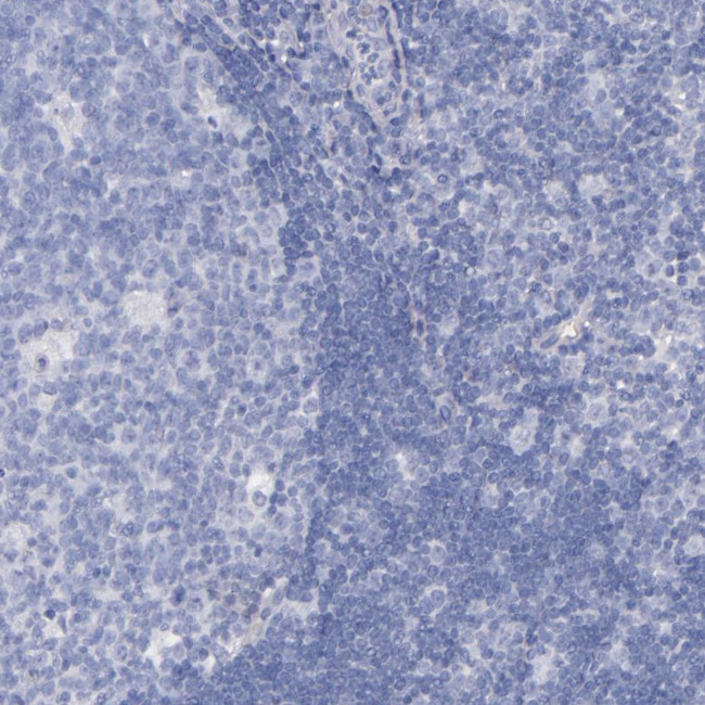 Kininogen 1 Antibody in Immunohistochemistry (Paraffin) (IHC (P))