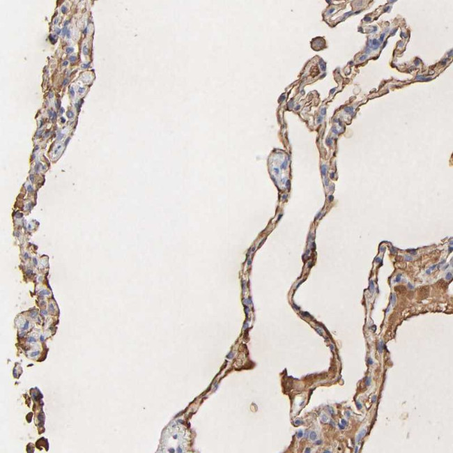 PAG1 Antibody in Immunohistochemistry (Paraffin) (IHC (P))