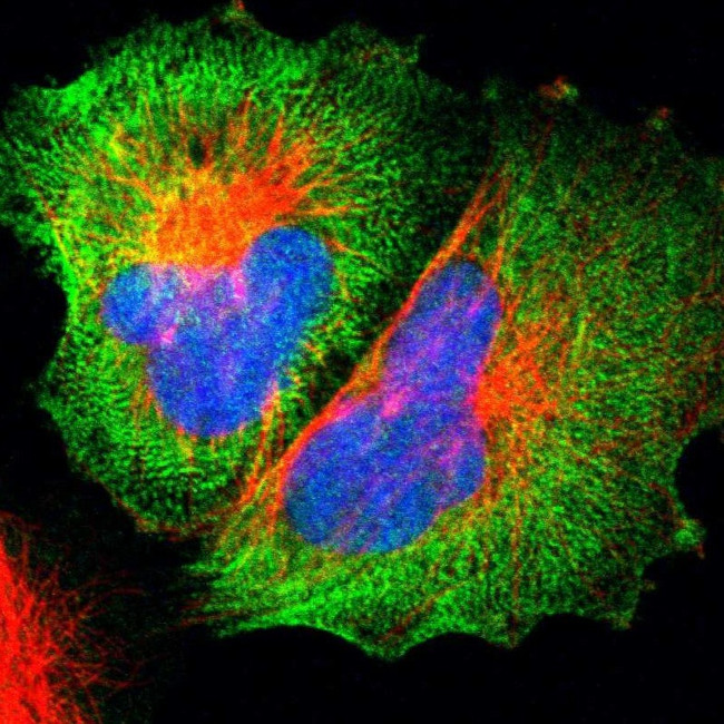 MYH9 Antibody in Immunocytochemistry (ICC/IF)