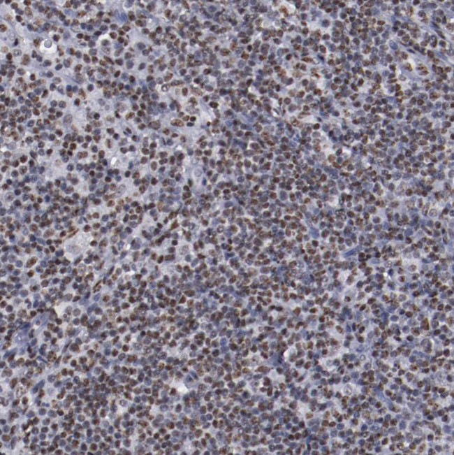 hnRNP A2B1 Antibody in Immunohistochemistry (Paraffin) (IHC (P))