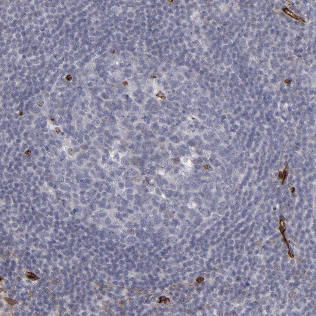 NHERF2 Antibody in Immunohistochemistry (Paraffin) (IHC (P))